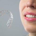 5 Questions to Ask Your Orthodontist About Invisalign